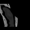 SPORK, NICO - 22.03.1976 - 02.08.2022 - CT obere Extremität - 18:01:46